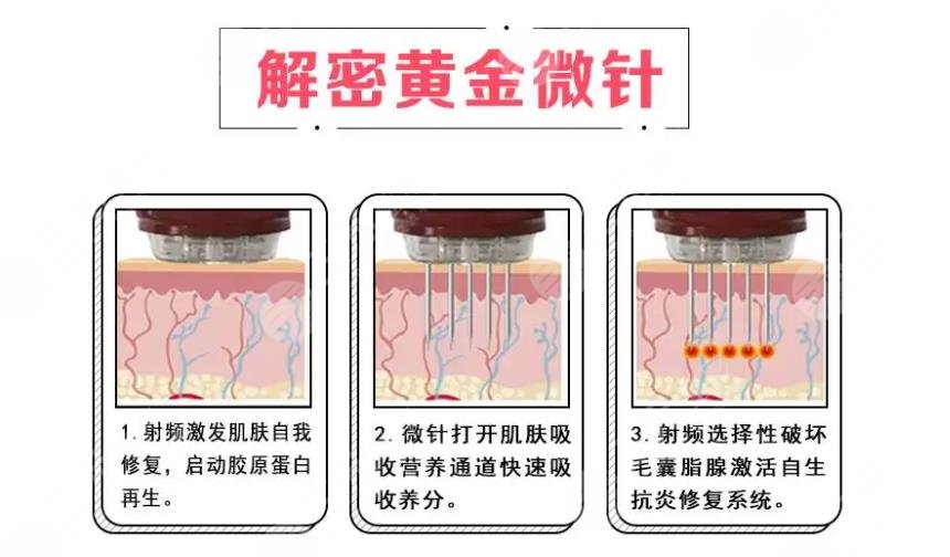 t區(qū)毛孔粗大怎么改良？