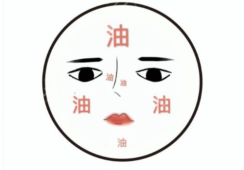 t區(qū)出油毛孔粗大怎么辦？