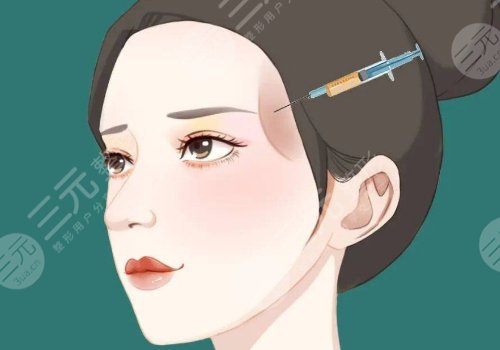 外輪廓提升需要幾支玻尿酸？