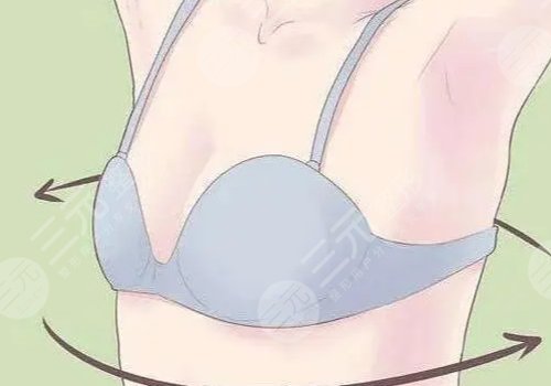 乳房填充能維持多久？