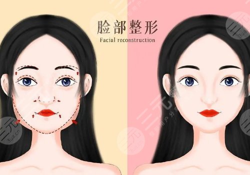全臉幼態(tài)臉打造大概需要多少費用？