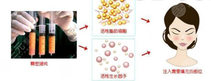 北京大學人民醫(yī)院整形科擅長項目科普