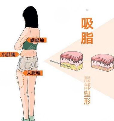 北京世紀(jì)壇醫(yī)院整形科擅長項目科普