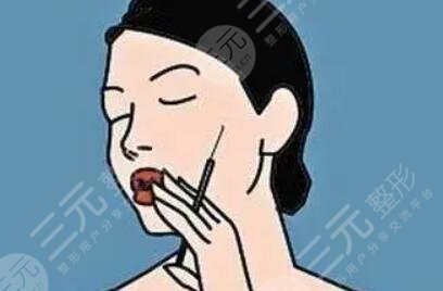 下巴整形