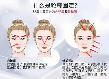 臉部輪廓固定能維持多久？