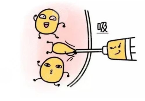 腰腹部抽脂對(duì)身體有什么傷害？