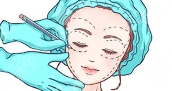 面部輪廓整形