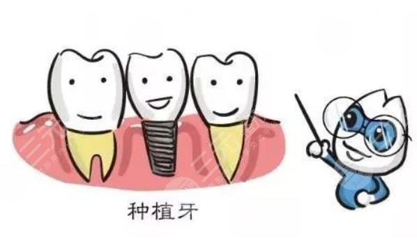 上海中山醫(yī)院口腔科擅長(zhǎng)項(xiàng)目