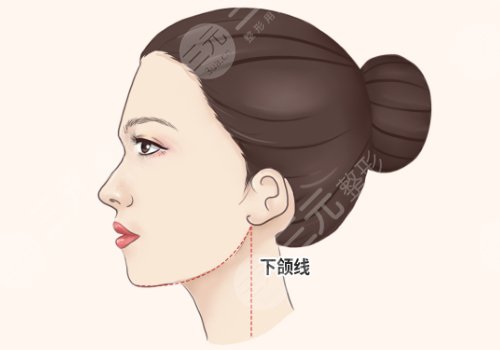 重慶華美何才偉磨骨怎么樣？