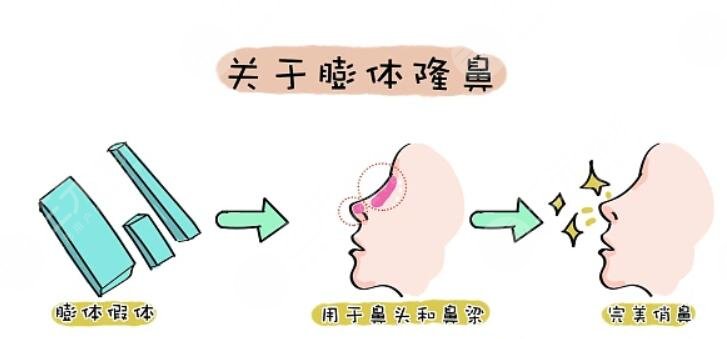 隆鼻維持的時(shí)間