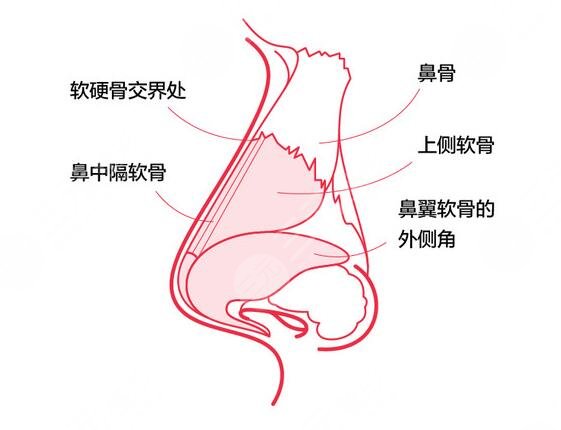 隆鼻維持的時(shí)間