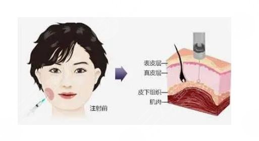 方圓臉怎么變成瓜子臉？