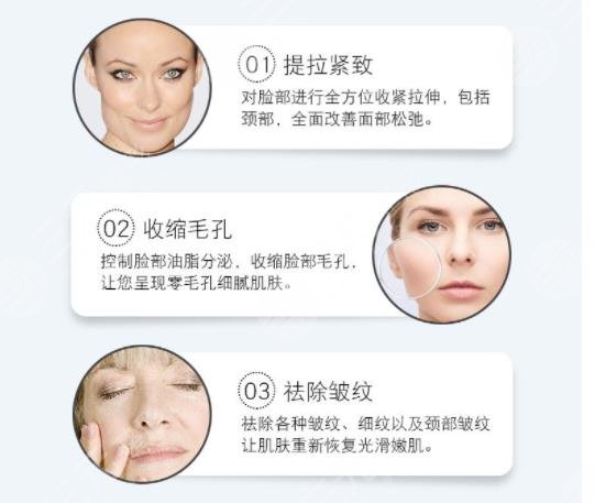 美國強生魚骨線雕能維持多久？