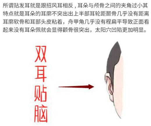 耳基底提升整形怎么做圖片科普！微整輪廓美學思路，我來教你~