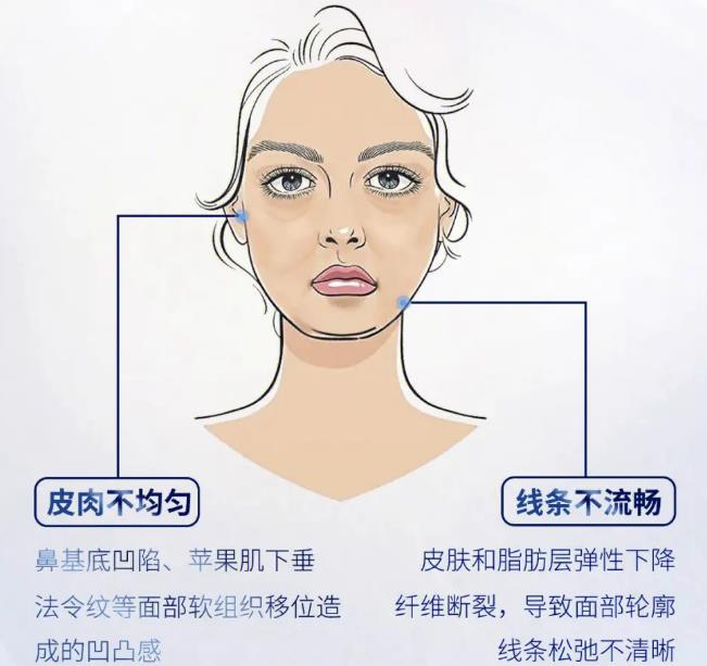 饅化臉怎么做減法？改良方案分享，這2個美學(xué)思路很重要！