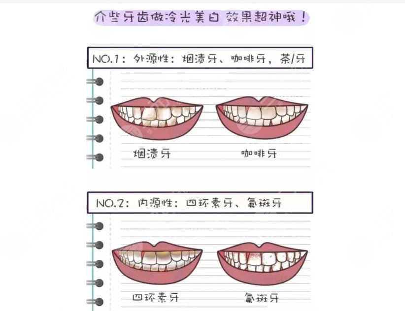 曲靖第一人民醫(yī)院口腔科醫(yī)生