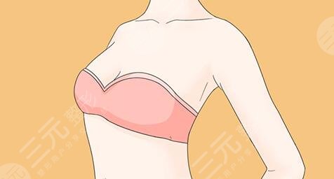 赫貝拉假體進(jìn)口還是國產(chǎn)的？隆胸界的“經(jīng)濟(jì)適用型”，優(yōu)勢(shì)分析