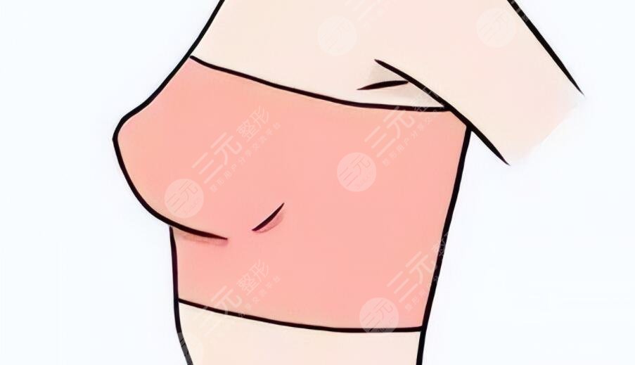 做了假體隆胸會(huì)不會(huì)癌變？乳腺專家跟蹤調(diào)查后總結(jié)~