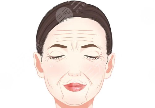 筋膜提升術(shù)多少錢？