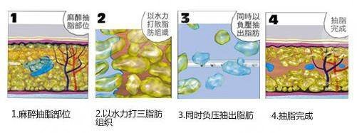 瘦肚子和腰上贅肉有效的方法有哪些？