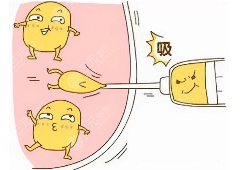 張朋醫(yī)生面部吸脂案例