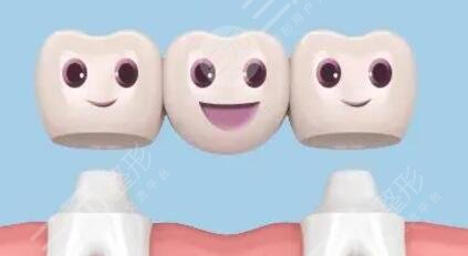 假牙