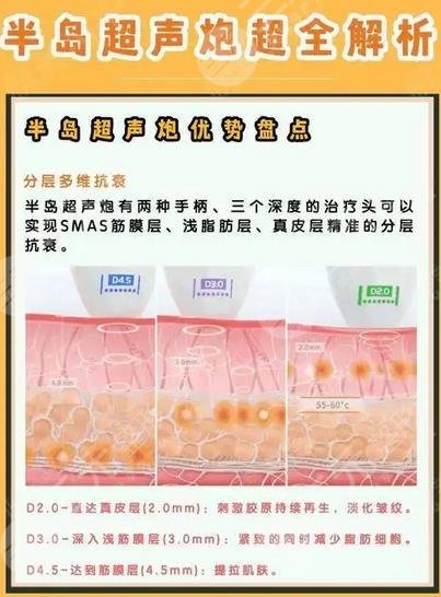 半島超聲炮黃金版價(jià)格是多少