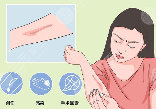 去色素疤痕好的方法
