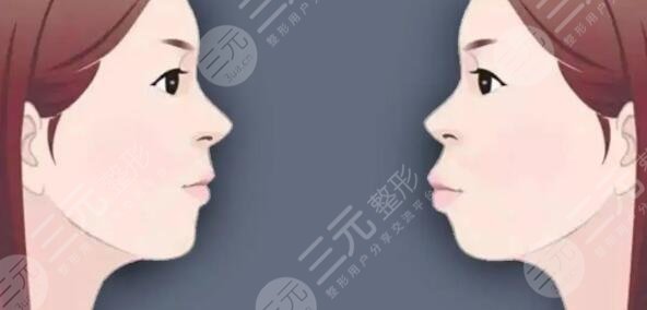 華西口腔醫(yī)院正頜手術(shù)擅長醫(yī)生