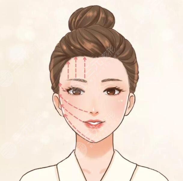 周敏茹醫(yī)生臉上微調案例