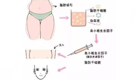林忠泵醫(yī)生特色項(xiàng)目