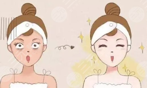 全身光子美白