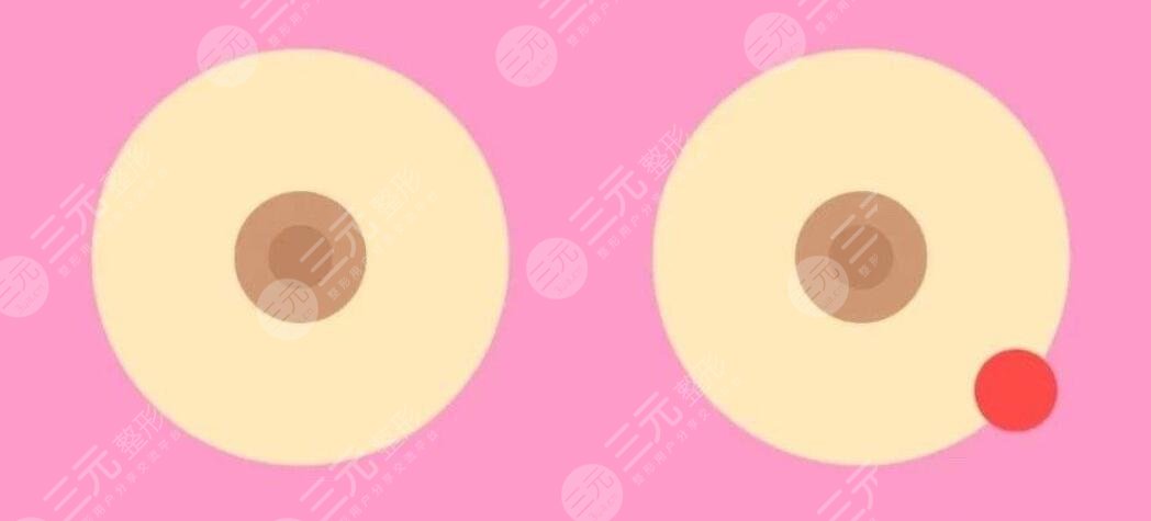 乳暈動漫