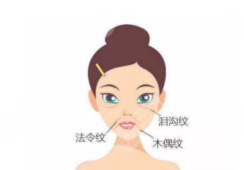 鼻唇溝太深怎么辦