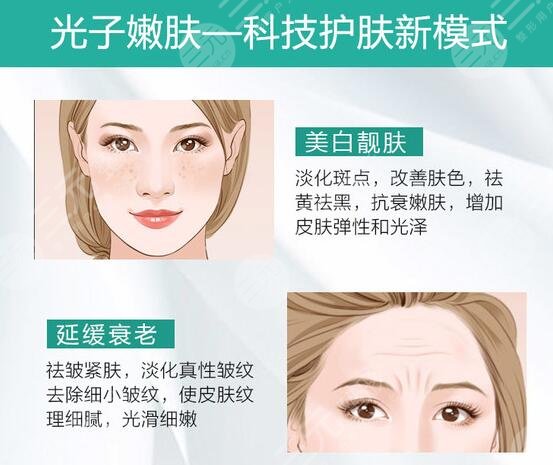 蝴蝶斑