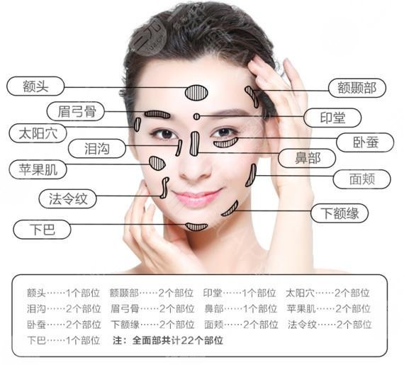 王紹國醫(yī)生做填充嗎