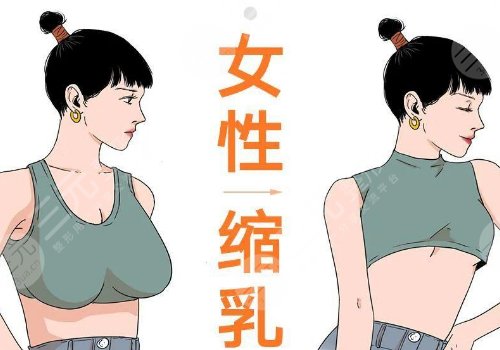 縮胸手術(shù)真實(shí)案例前后對比圖案例分享