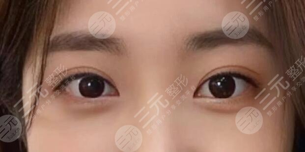 肖貴喜醫(yī)生做雙眼皮怎么樣?。酷t(yī)生個(gè)人實(shí)力測(cè)評(píng)，就職醫(yī)院是哪家？