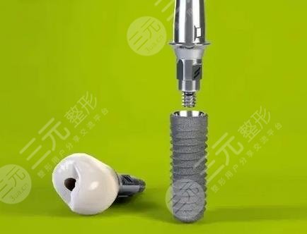 上海第十人民醫(yī)院種植牙的價格怎么樣