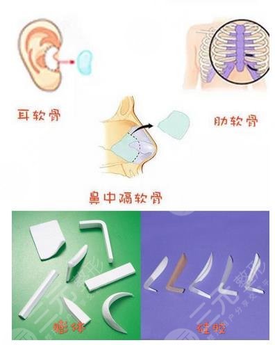 李哲權醫(yī)生隆鼻整形案例