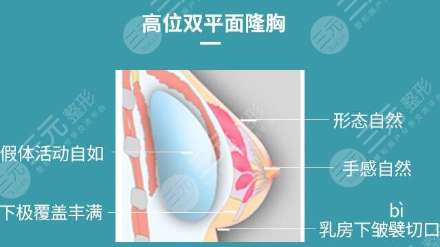 隆胸