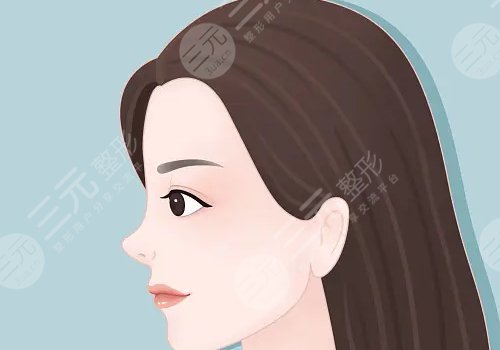 上海九院歪鼻矯正專家 
