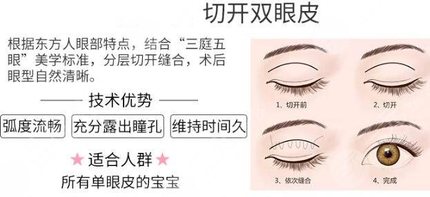 雙眼皮