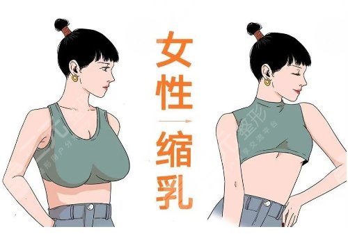 浙江醫(yī)院縮胸手術(shù)費(fèi)用