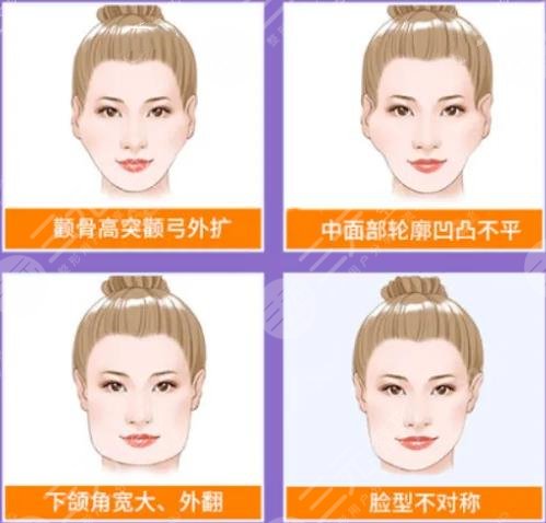 顴骨磨骨手術(shù)過程科普！頜面整形不簡單，術(shù)前知識(shí)點(diǎn)掃盲！