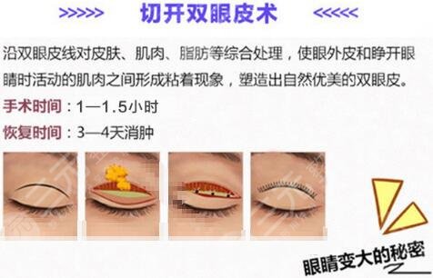 付敏醫(yī)生怎么樣？成都人氣整形醫(yī)生，簡介、雙眼皮案例點(diǎn)評！