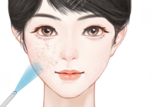 做醫(yī)美多少錢一個月