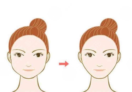 顴骨內(nèi)推老了會怎么樣