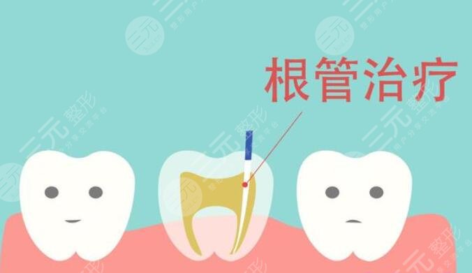 根管