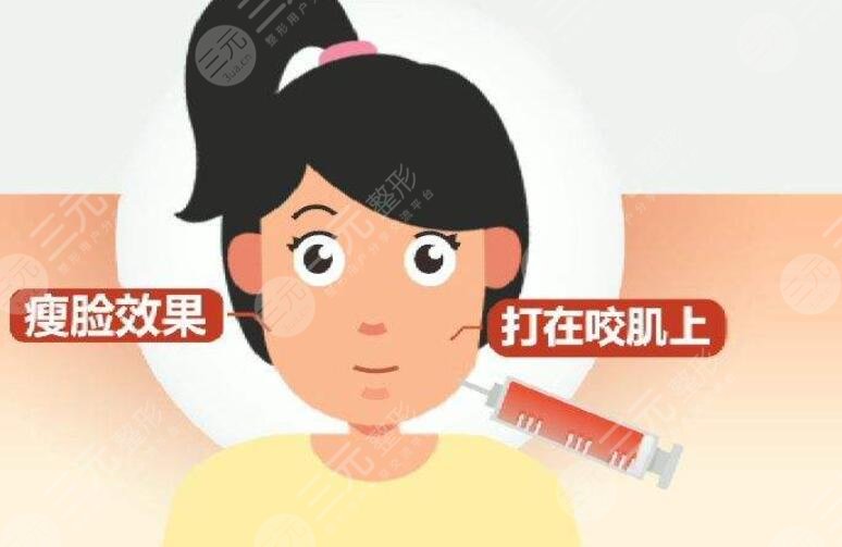 瘦臉針